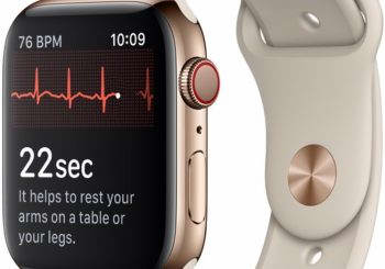 Функция ЭКГ теперь доступна пользователям Apple Watch в Европе"